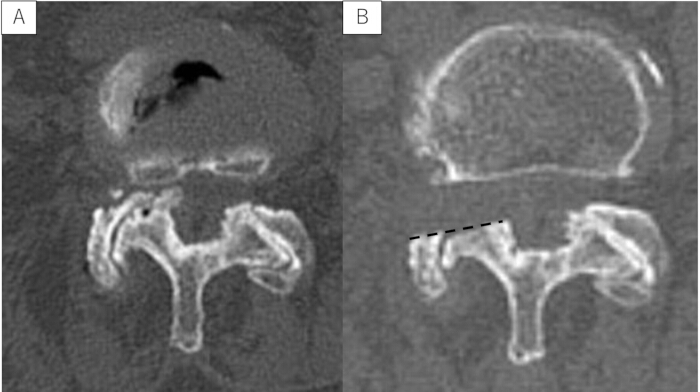 figure-results-8 CT scan image showing cranial cross-section comparison; highlighting internal structure differences.