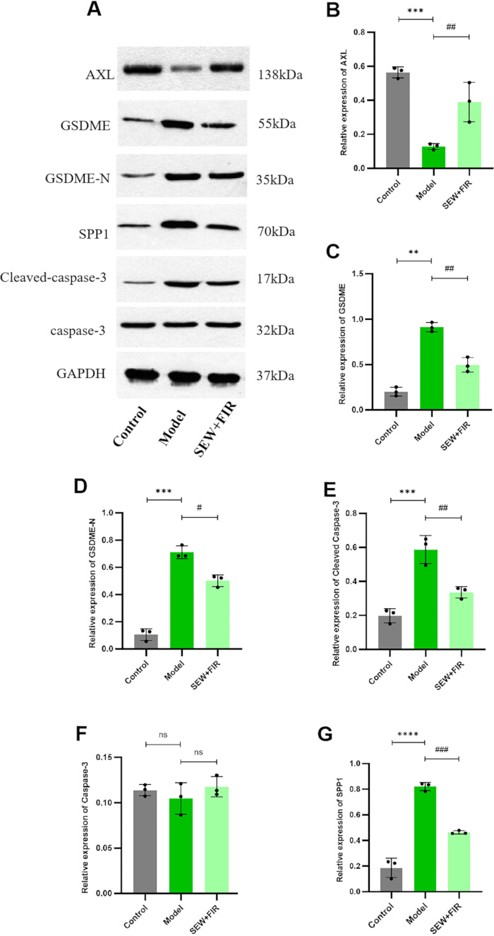 figure-results-8 Western blot analysis; AXL, GSDME expression; diagram; protein quantification; therapeutic effects.