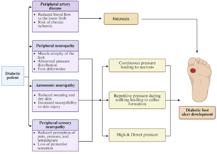 Diabetic foot ulcer development flowchart; processes include necrosis, neuropathy, pressure impacts.