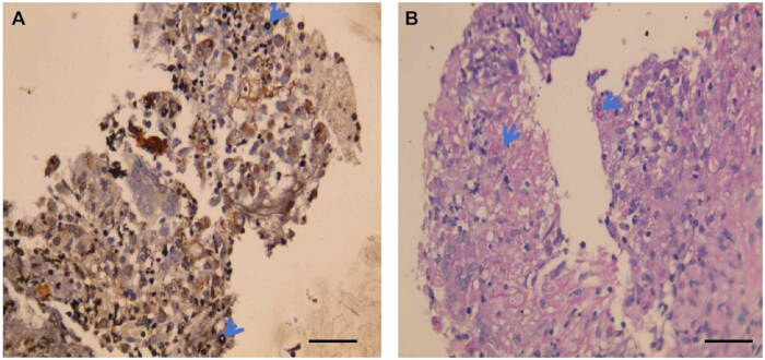 Histology comparison; stained tissue sections; microscopy image; cellular morphology analysis.