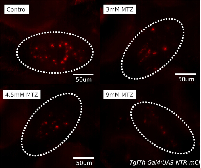 Fluorescence microscopy results showing MTZ effect on cells; 50um scale, MTZ concentrations labeled.