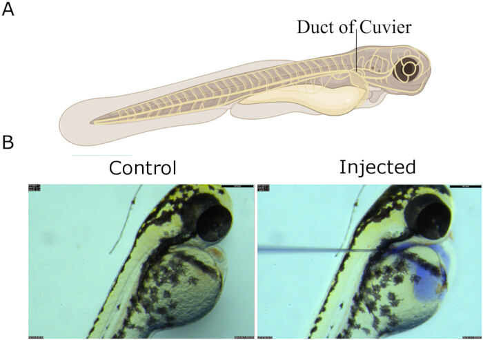 Zebrafish embryo diagram and microscope comparison; control vs. injected, highlighting Duct of Cuvier.