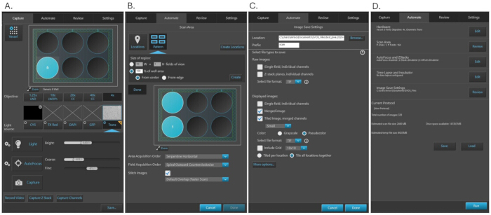 Microscope imaging setup screens; multiwell plate, image acquisition options, and data protocol review.