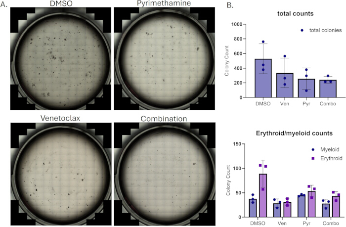 Colony formation assay results; drug impact on cell colonies; bar graph shows total and cell-type counts.