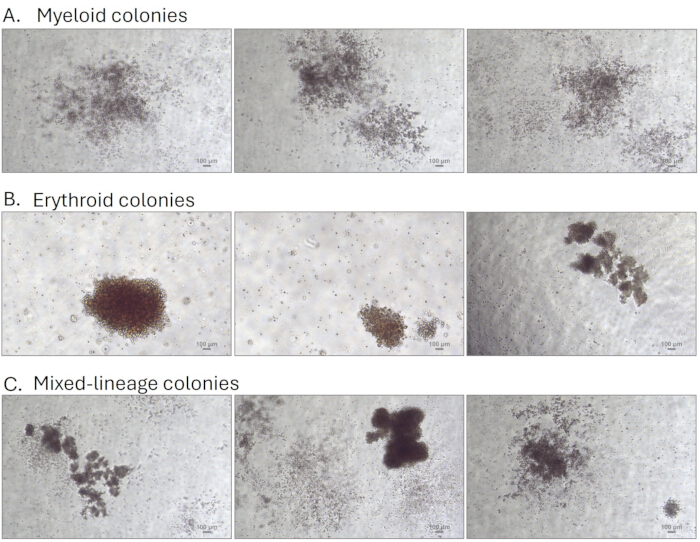 Microscopy of myeloid, erythroid, mixed-lineage colonies in hematopoietic cell differentiation study.