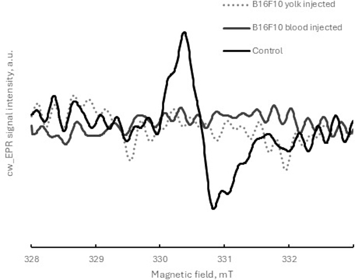 figure-results-6 cw-EPR spectra showing B16F10 yolk, blood injected, and control; magnetic field vs. intensity graph.