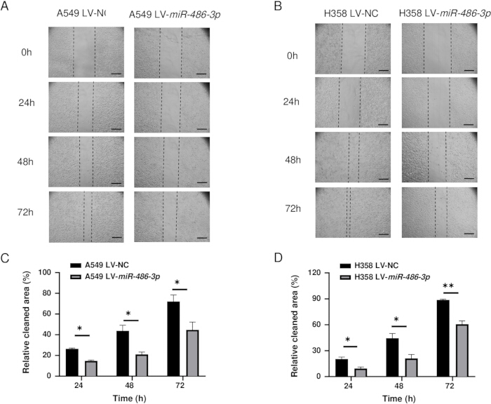 figure-results-7 Wound healing assay, A549/H358 cells, miR-486-3p effect, time-lapse microscopy, bar charts.