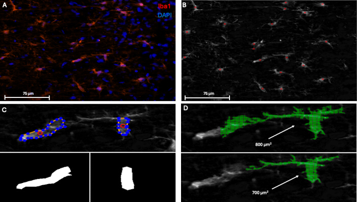 figure-results-2 显示小胶质细胞(Iba1,DAPI)及细胞形态学分析的荧光显微镜图像。