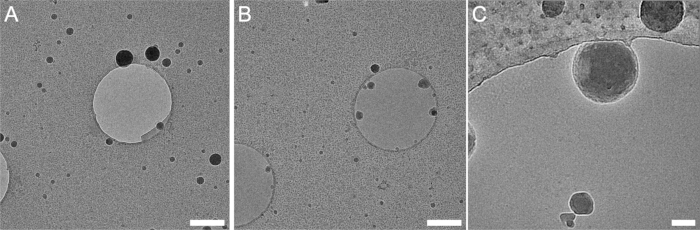 Electron microscopy image of lipid vesicle structures; scale bar visible; cellular membrane study.