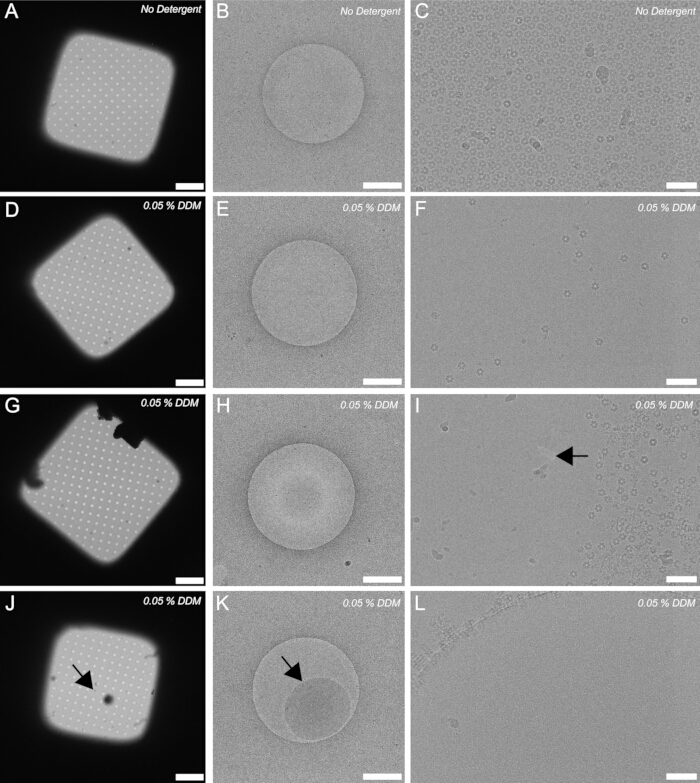 Cryo-EM grid evaluation; detergent effects; microscopy images; nanoparticles, structural analysis.