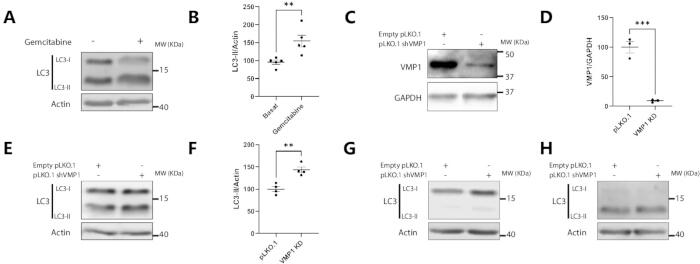Protein expression via Western blot, LC3-II/Actin ratio, VMP1/GAPDH, effects of Gemcitabine, shVMP1.