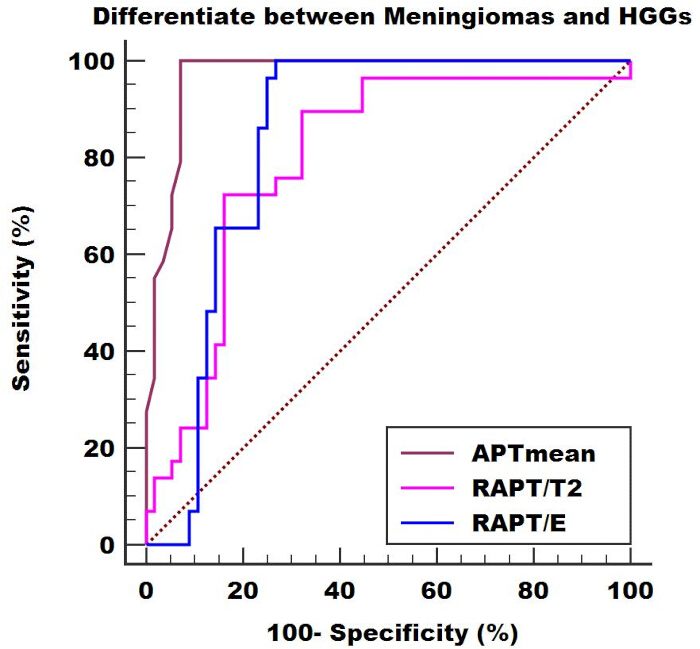 ROC curve differentiating meningiomas and HGGs; chart shows sensitivity vs. specificity analysis.