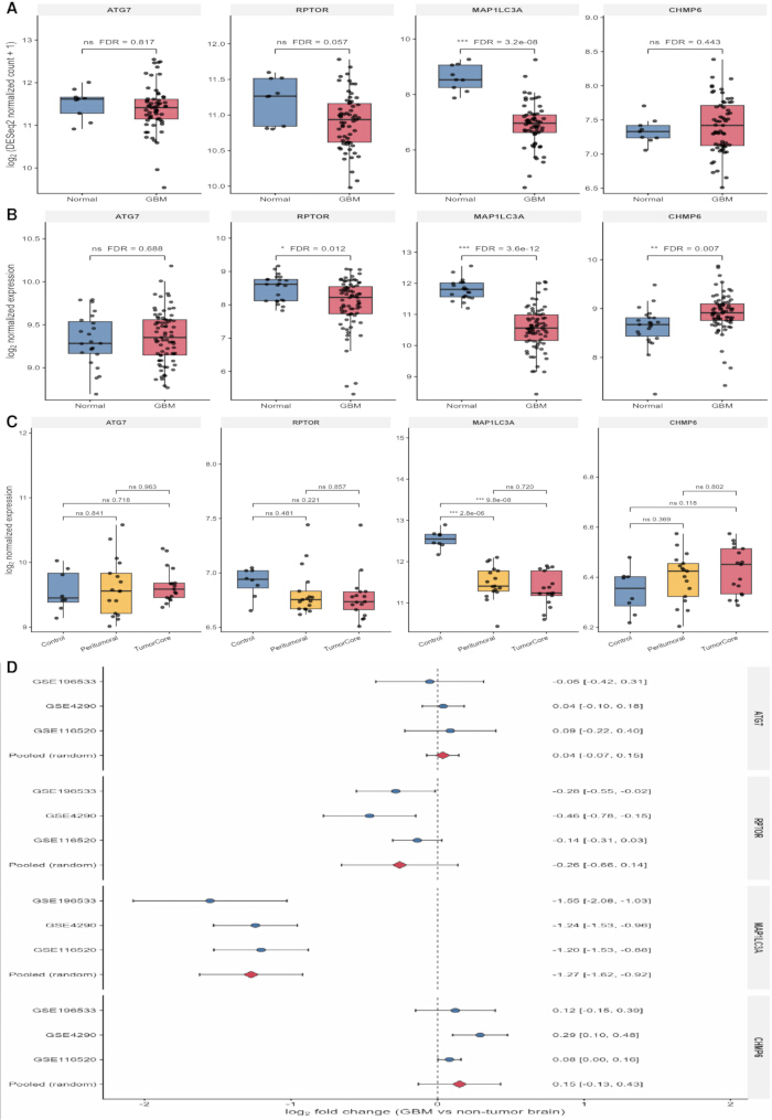 Box plot and forest plot comparison of gene expression in GBM vs normal brain analysis, statistical results.