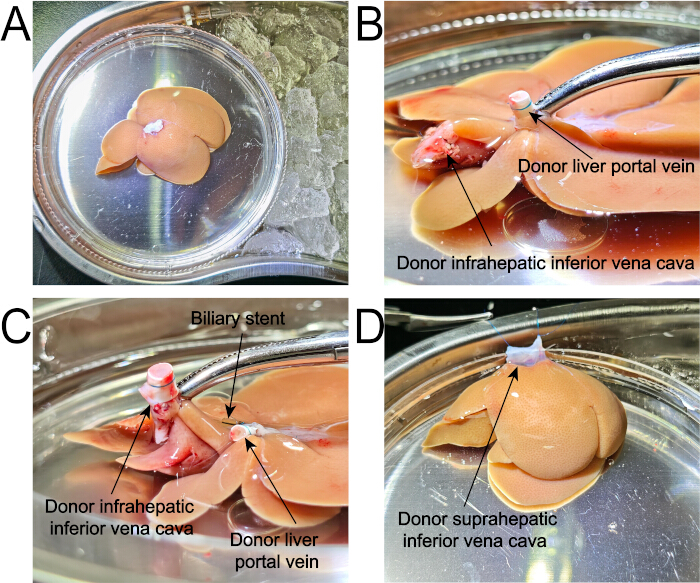 figure-protocol-4 Liver transplantation procedure with biliary stent; anatomical vessel connections; experimental setup.