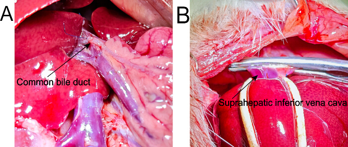 figure-protocol-5 Anatomical dissection highlighting the common bile duct, suprahepatic inferior vena cava.