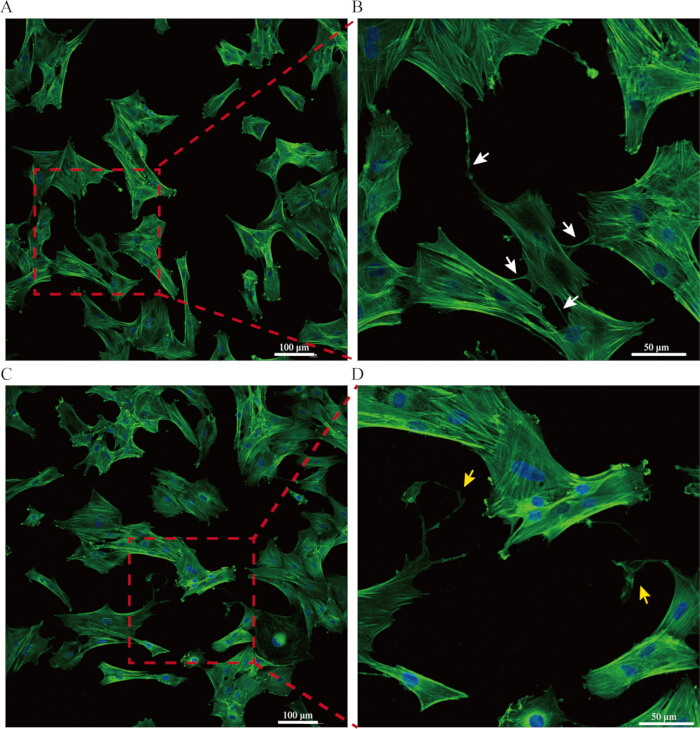 Fluorescence microscopy of cell cytoskeleton, actin fibers highlighted; high-resolution imaging.