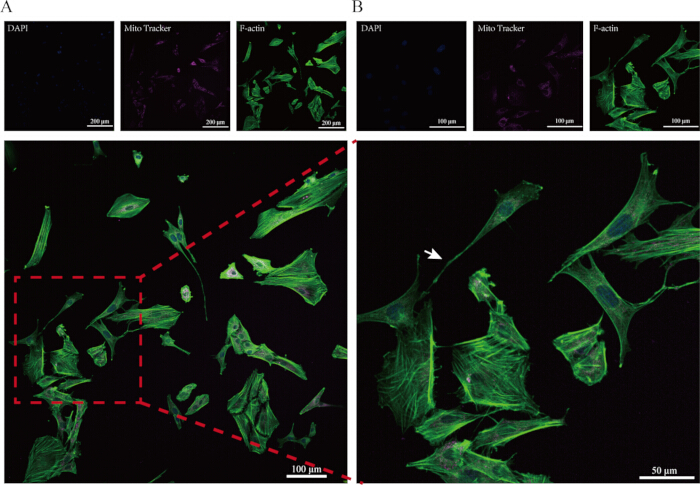 Fluorescence microscopy diagram displaying DAPI, MitoTracker, and F-actin in cell structure analysis.