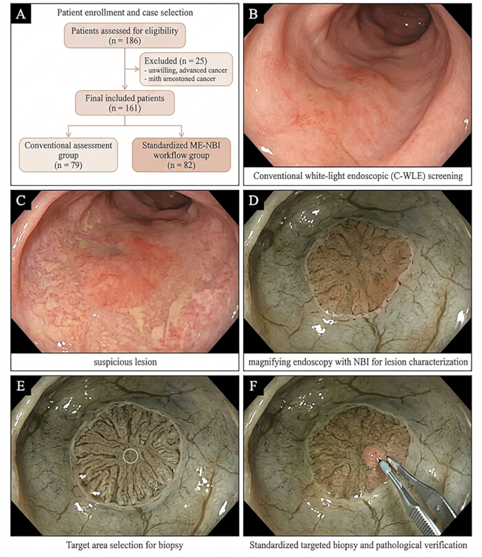 Patient assessment process, endoscopic screening, lesion biopsy; diagram and endoscopic images.