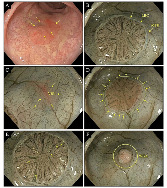 Endoscopic images of gastric mucosa with labeled regions for clinical analysis and diagnosis.