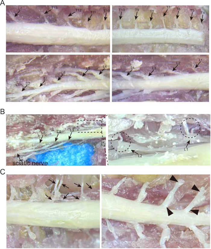 Dissection and Isolation of Mouse Dorsal Root Ganglia