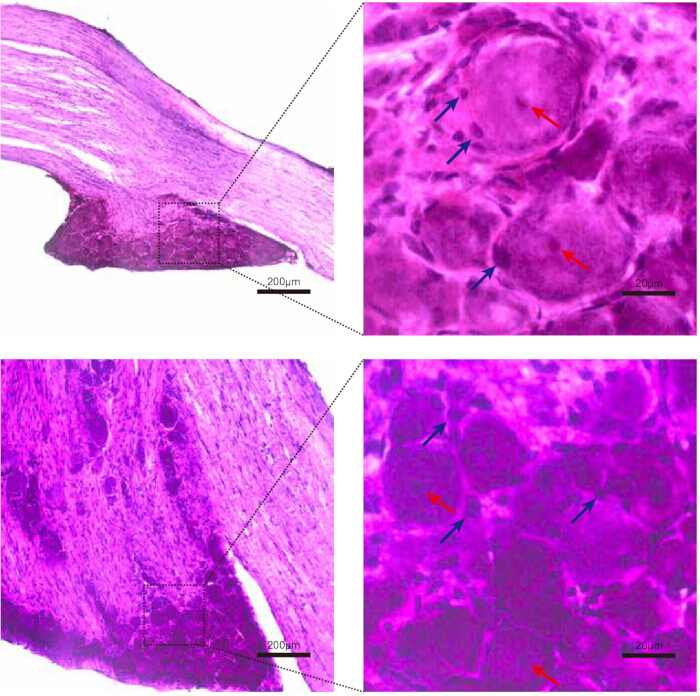 Dissection and Isolation of Mouse Dorsal Root Ganglia