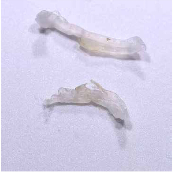 Dissection and Isolation of Mouse Dorsal Root Ganglia