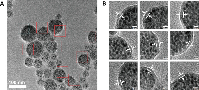 figure-results-1 Nanoparticle structure in TEM images; electron microscopy analysis showing clustered nanoparticle detail.