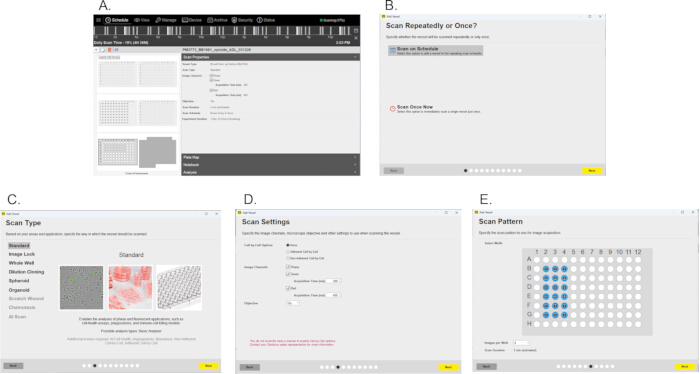 figure-results-3 Automated scan configuration; settings interface; data acquisition; imaging analysis; software guide.