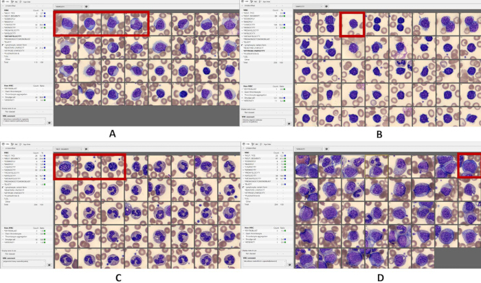 figure-results-2 Cellular microscopy results; image analysis software screens compare cell morphologies across samples.