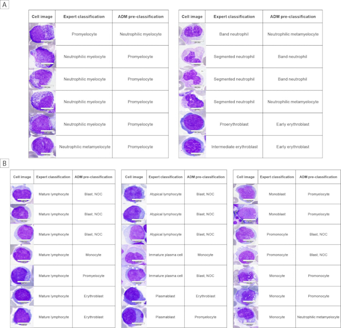 figure-results-4 Hematology cell classification chart comparing expert and ADM results, highlighting cell types.