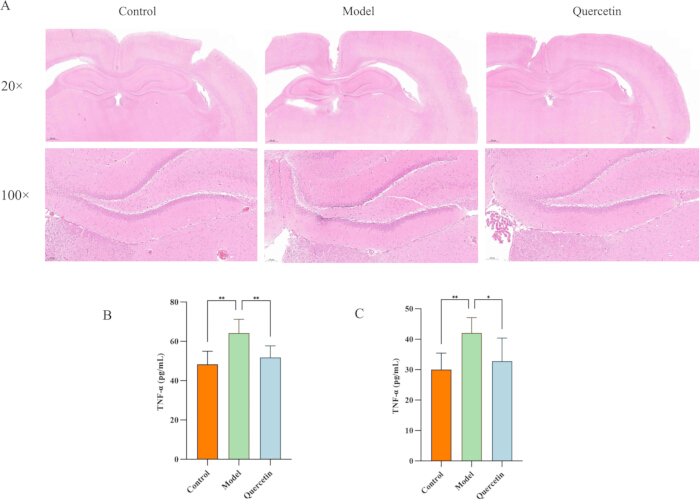 figure-results-9 Histology slides, quercetin effects on brain tissue. TNF-α levels in bar graphs for control, model.