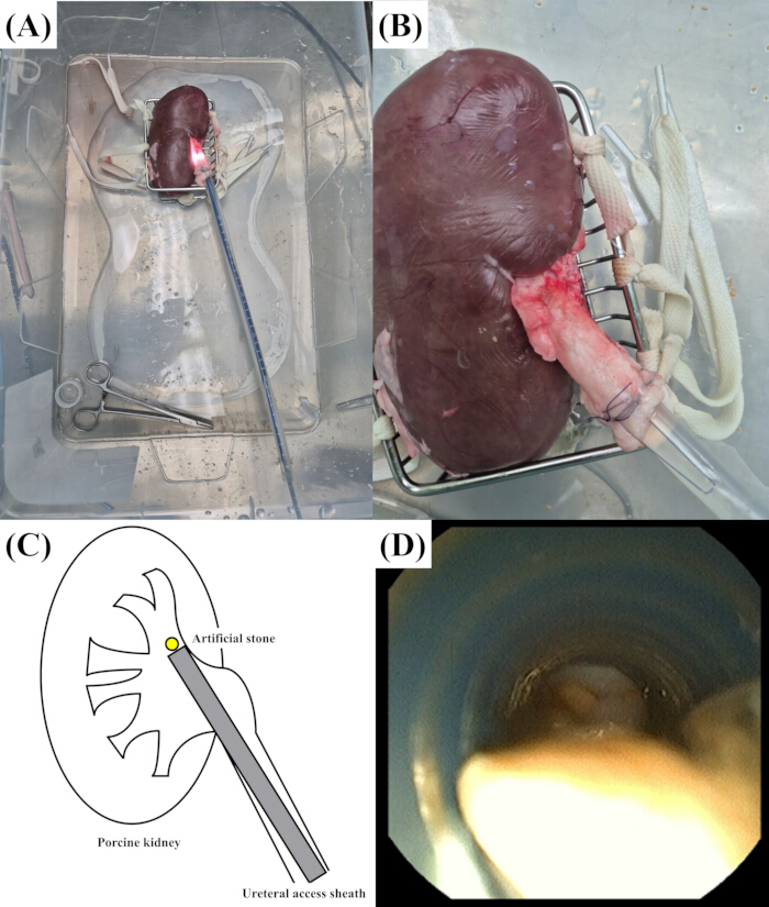 figure-results-1 Porcine kidney experiment with artificial stone, ureteral access; diagram and endoscopic view.