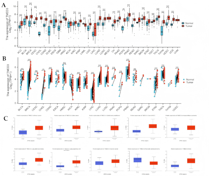 figure-results-1 TMED3 expression box plots; cancer vs normal tissue analysis, statistical data comparison.