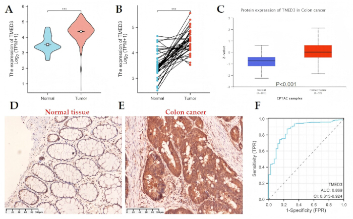 figure-results-9 TMED3 expression in colon cancer: violin plots, box plot, tissues, ROC curve; comparative analysis.