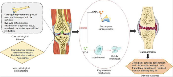 Cartilage degeneration process diagram; shows core factors, molecular mechanisms, and osteoarthritis.