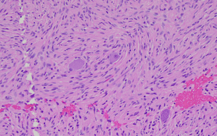 Histology slide showing cellular structures; microscopy image, tissue sample, medical analysis.