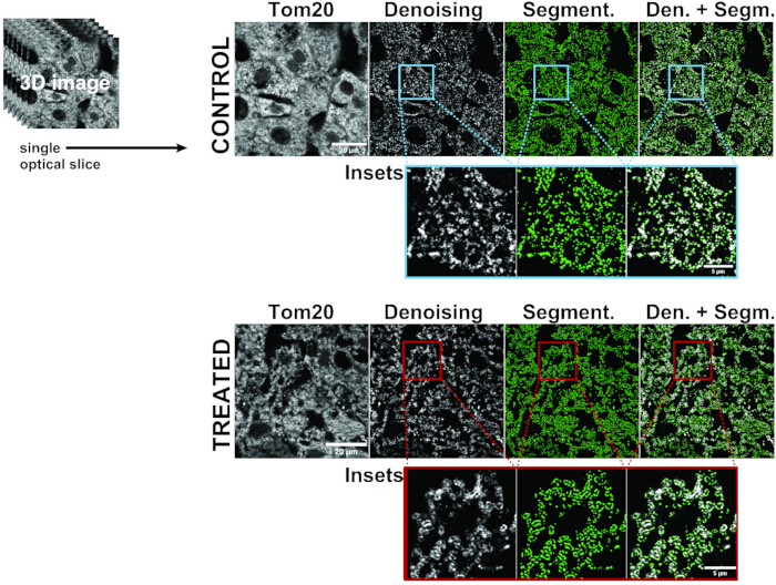 figure-results-2 3D optical slice images; control vs. treated; Tom20 denoising, segmentation; microscopy analysis.