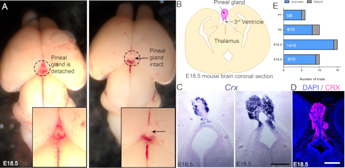 E18.5 mouse brain anatomy; pineal gland attachment, coronal section diagram, Crx expression, DAPI/CRX.