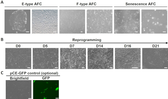figure-results-1 Reprogramming AFC into pluripotent cells diagram; microscopy images; GFP control; cell morphology.