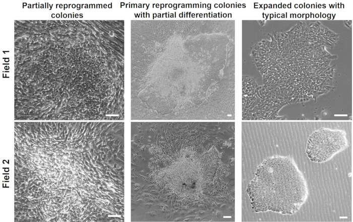 figure-results-2 Microscope image of cell reprogramming stages with morphology details across two fields.