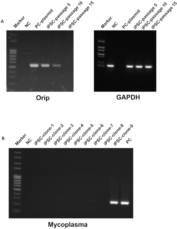 figure-results-5 Gel electrophoresis results; Orip, GAPDH, Mycoplasma detection in iPSC samples; DNA band analysis.