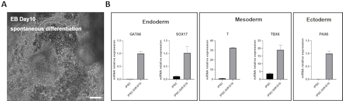 figure-results-6 Microscope image with graphs showing gene expression during cell differentiation: endoderm, mesoderm, ectoderm.
