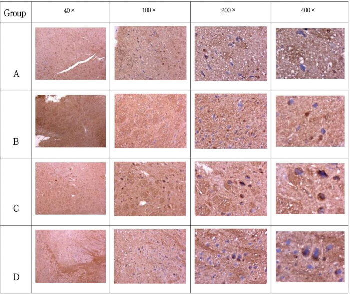 figure-results-1 Histology slide comparison; magnification 40x-400x; microscope images of tissue groups A-D.