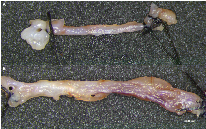 Nerve graft comparison; microscope image; nerve regeneration experiment; tissue repair analysis.