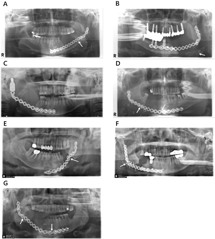 figure-results-2 figure-results-2