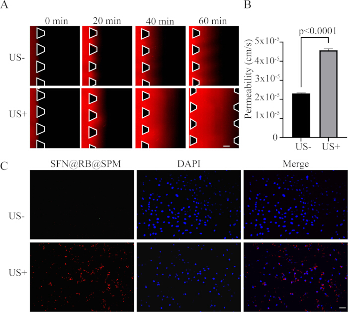 figure-results-3 Cell permeability study with ultrasound application; includes time-lapse images, permeability bar graph, and fluorescence microscopy with DAPI staining comparison.