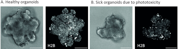 figure-results-2 Healthy vs. phototoxic organoids, microscope images; cellular health assessment and phototoxicity study.