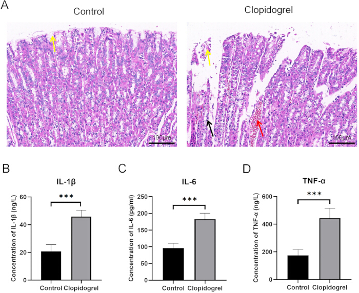肠道组织的组织学比较及IL-1β、IL-6和TNF-α水平的图表结果。