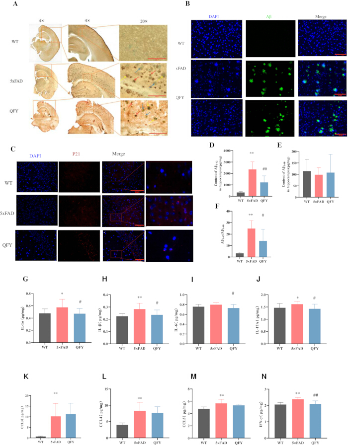 figure-results-5 Brain tissue histology and immunofluorescence images, bar graph data on Aβ levels, cytokine comparison.
