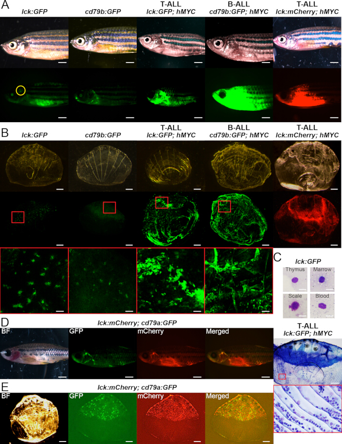 figure-results-1 Zebrafish microscopy; lck:GFP; cd79:GFP; T-ALL; B-ALL fluorescence; thymus; marrow; gene expression.